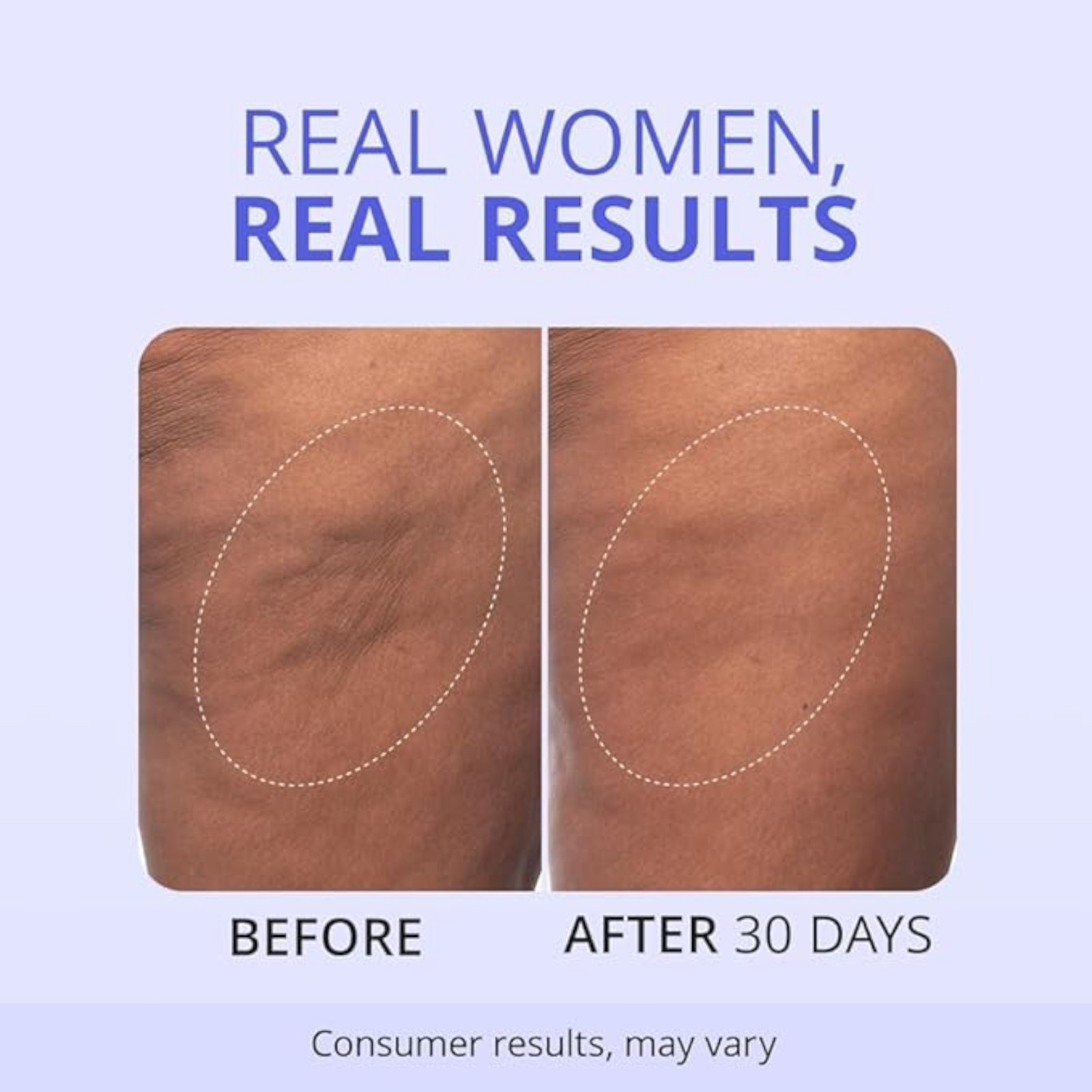 goPure Firming Butt & Thigh Cream – Smooths the look of dimpled texture, fades the look of stretch marks - Clinically Tested