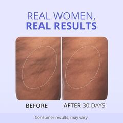 goPure Firming Butt & Thigh Cream – Smooths the look of dimpled texture, fades the look of stretch marks - Clinically Tested